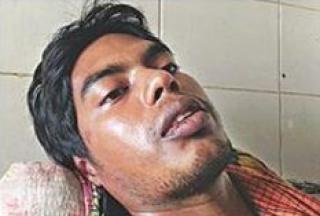 তরিকুল ইসলামের পায়ের অবস্থা আশঙ্কাজনক