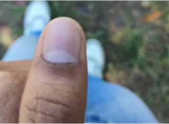 চাকসু নির্বাচনে কালি মুছে যাওয়ার অভিযোগ – ছাত্রদল জানায় অভিযোগ দেবে