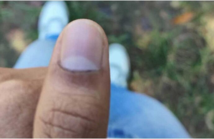 চাকসু নির্বাচনে কালি মুছে যাওয়ার অভিযোগ – ছাত্রদল জানায় অভিযোগ দেবে