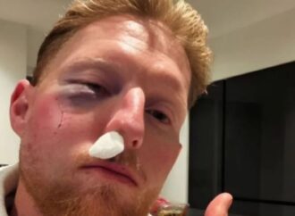 বলের আঘাতে গুরুতর চোটের কবলে বেন স্টোকস