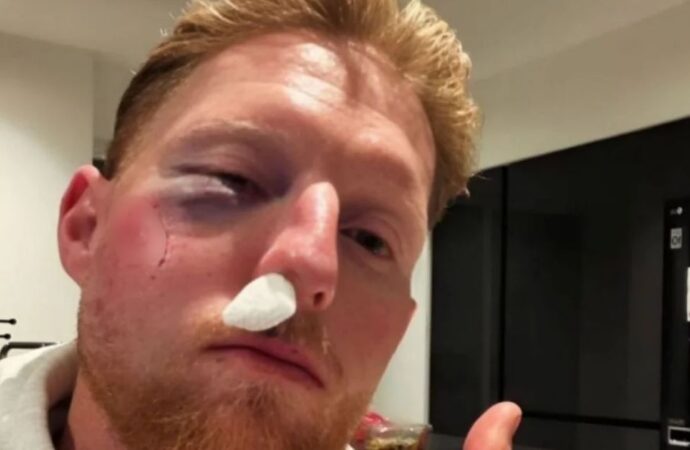 বলের আঘাতে গুরুতর চোটের কবলে বেন স্টোকস