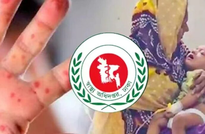 হাম উপসর্গে নিয়ে আরও ৮ শিশুর মৃত্যু, হাসপাতালে রেকর্ড ভর্তি