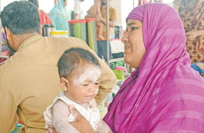 হাম ও হামের উপসর্গে আরও ৯ শিশুর মৃত্যু, ৫ জনই ঢাকার