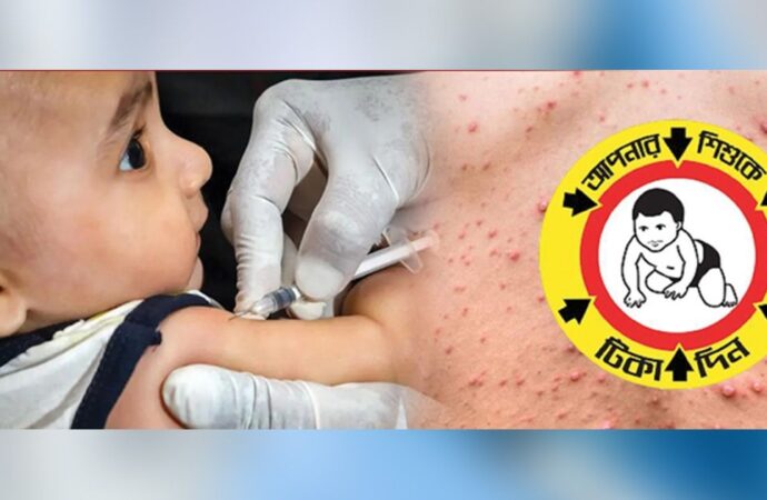 টিকাদানের মধ্যেও থামছে না হামে মৃত্যু