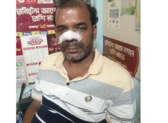 মরিচের গুঁড়ো ছুঁড়ে ব্যবসায়ীর নগদ টাকা ও মোবাইল লুট