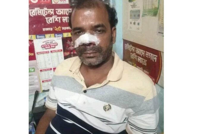 মরিচের গুঁড়ো ছুঁড়ে ব্যবসায়ীর নগদ টাকা ও মোবাইল লুট