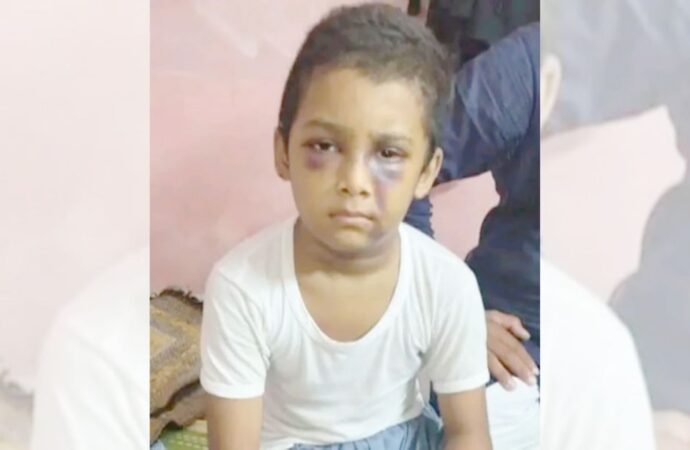 মাদ্রাসায় শিশু নির্যাতন ঘটনায় সোনাডাঙ্গা থানায় মামলা