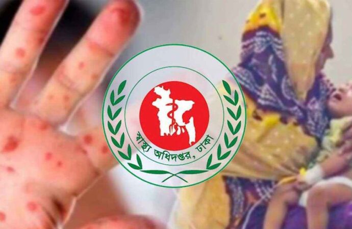 হাম-ডেঙ্গুতে একদিনেই মৃত্যু ৮, বাড়ছে উদ্বেগ